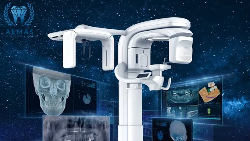 اسکن سه بعدی دندان CBCT با بیمه بانک سامان