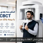 اسکن سه بعدی دندان CBCT با بیمه بانک مسکن