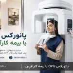 اسکن سه بعدی دندان CBCT با بیمه بانک پاسارگاد