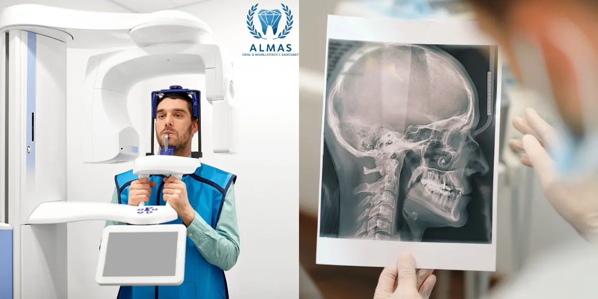 اسکن سه بعدی دندان CBCT با بیمه سامان درمانت