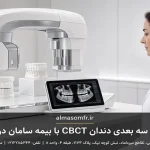 اسکن سه بعدی دندان CBCT با بیمه سامان درمانت