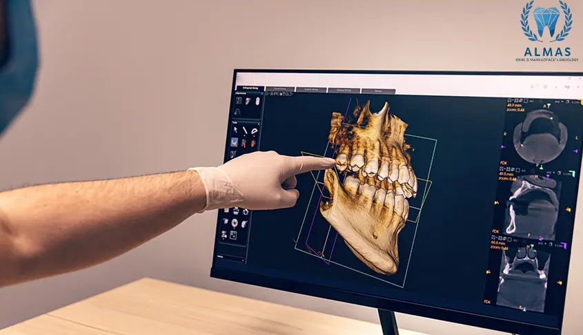 اسکن سه بعدی دندان CBCT با بیمه سینا