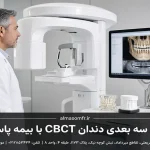 اسکن سه بعدی دندان CBCT با بیمه پاسارگاد