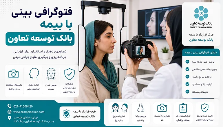 فتوگرافی بینی با بیمه بانک توسعه تعاون