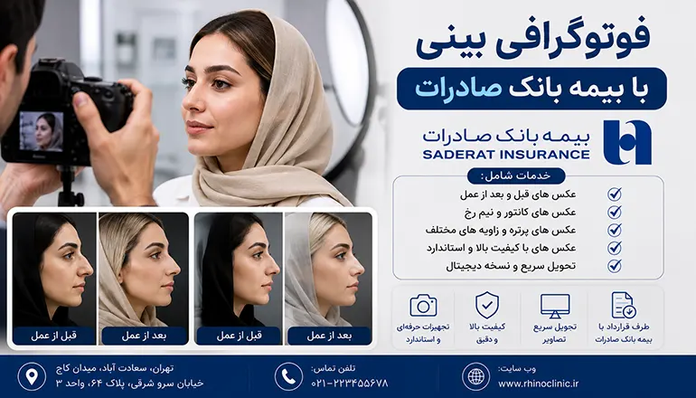 فتوگرافی بینی با بیمه بانک صادرات