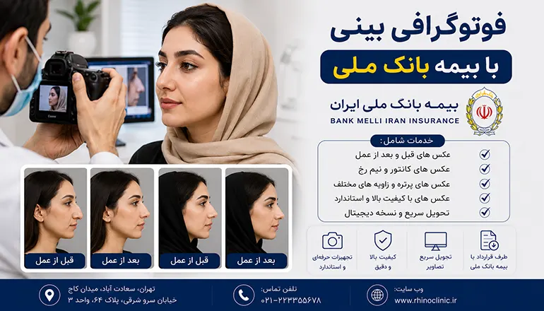 فتوگرافی بینی با بیمه بانک ملی
