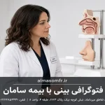 فتوگرافی بینی با بیمه سامان