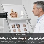 فتوگرافی بینی با بیمه سامان درمانت