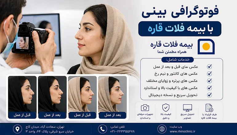 فتوگرافی بینی با بیمه فلات قاره
