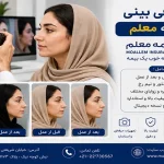 فتوگرافی بینی با بیمه معلم