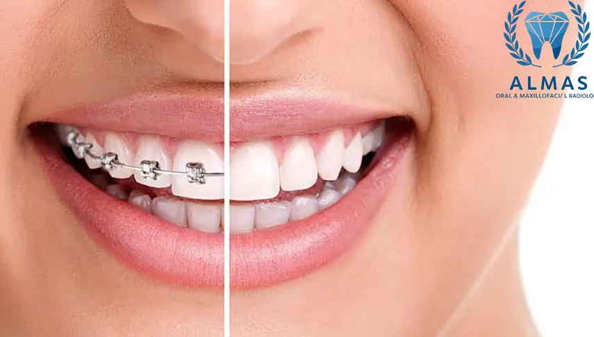 فوتوگرافی ارتودنسی با بیمه بانک سپه