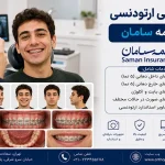 فوتوگرافی ارتودنسی با بیمه سامان