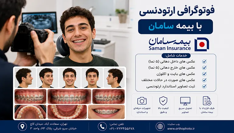 فوتوگرافی ارتودنسی با بیمه سامان