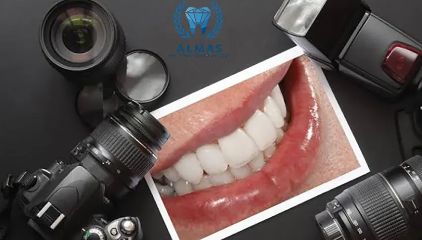 فوتوگرافی ارتودنسی با بیمه سامان