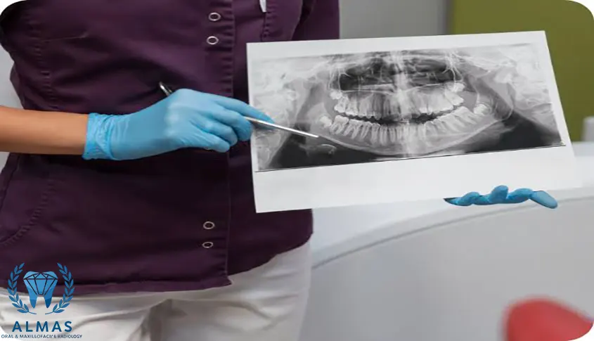 اسکن سه بعدی دندان CBCT با بیمه ما