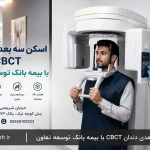 اسکن سه بعدی دندان CBCT با بیمه بانک توسعه تعاون