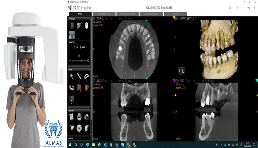 اسکن سه بعدی دندان CBCT با بیمه بانک سینا