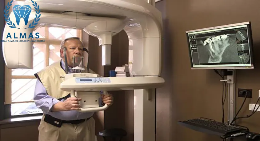 اسکن سه بعدی دندان CBCT با بیمه بانک صادرات