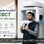 اسکن سه بعدی دندان CBCT با بیمه بانک کشاورزی