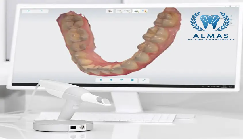 اسکن سه بعدی دندان CBCT با بیمه تعاون