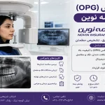پانورکس OPG با بیمه نوین