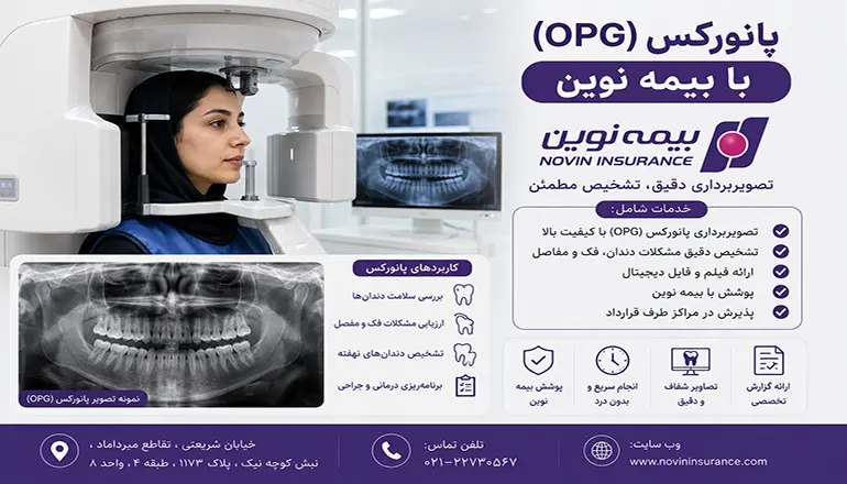 پانورکس OPG با بیمه نوین